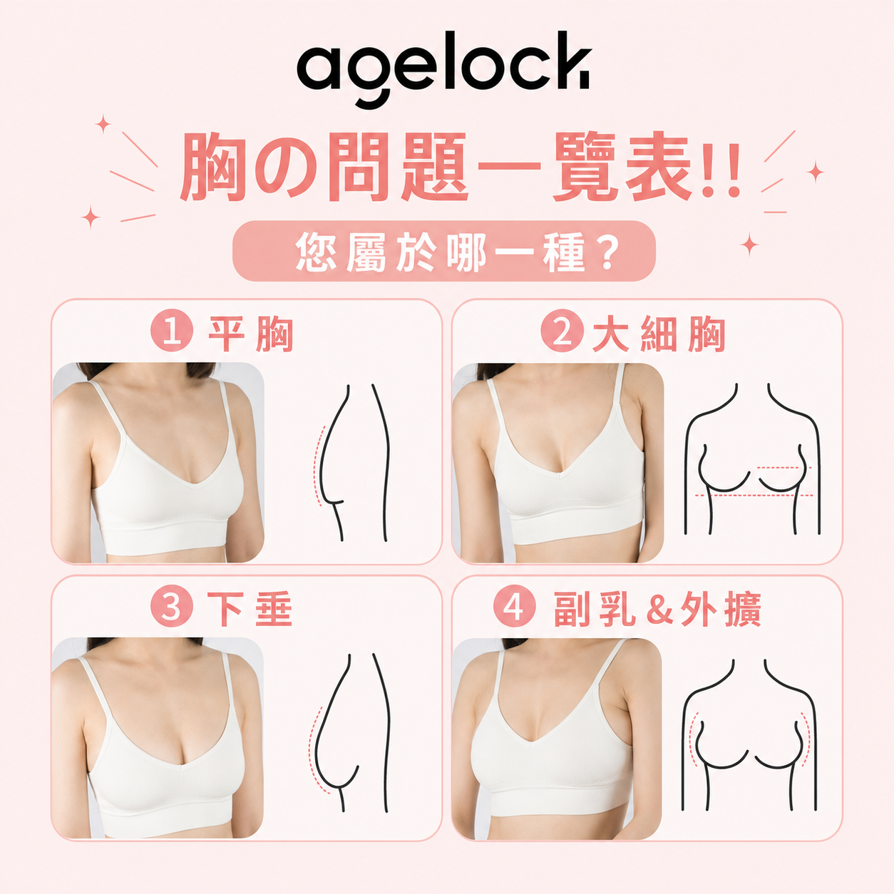 宮·乳同路療程 宣傳配圖